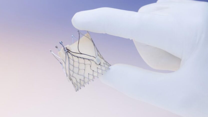 New Advancements in Aortic Valve Technology
